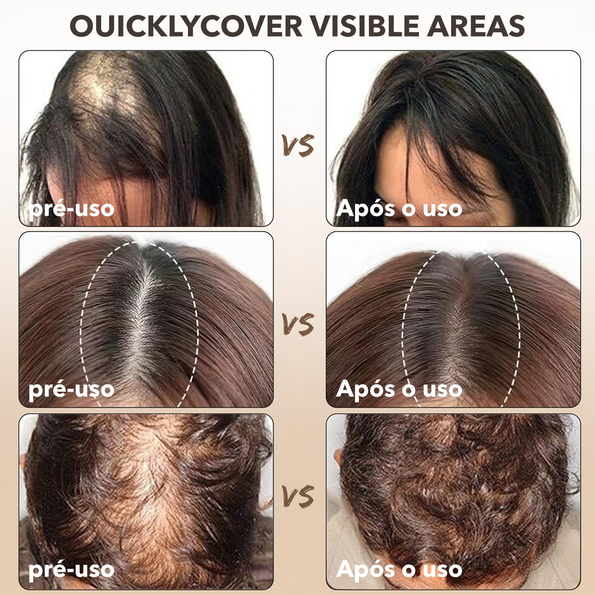 Pó De Retoque Capilar Sombra À Prova D'água Linha Capilar Cobertura Instantânea De Raiz